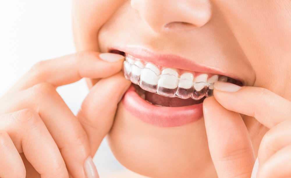 Top 10 Family Dentistry Tips For Healthy Smiles