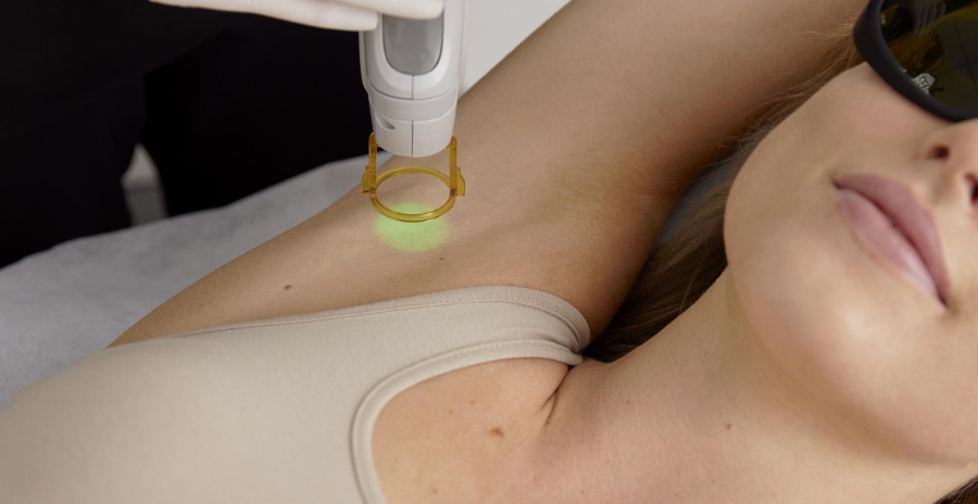 The Ultimate Laser Hair Removal Guide